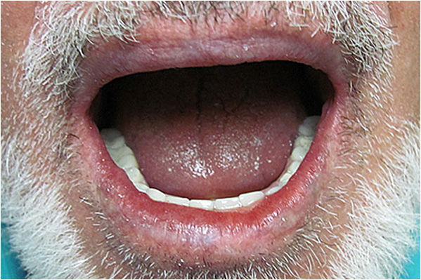 The image shows an elderly man with a full beard and mustache, who appears to be speaking or singing, with his mouth open wide enough to show teeth and tongue, set against a plain background that does not distract from the subject.