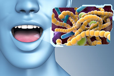 The image features a 3D rendering of a human face with an open mouth, displaying a blue tongue, set against a background with a scientific illustration of bacteria and viruses.