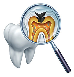 The image shows a magnified view of a human tooth with an X-ray overlay, highlighting its internal structure and the presence of a cavity, viewed through a magnifying glass.