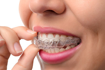 An adult female with braces is pulling on a toothpaste cap while looking directly at the camera.