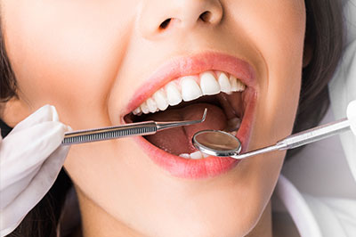 A woman with a wide smile undergoing dental treatment, with dental tools visible around her mouth.