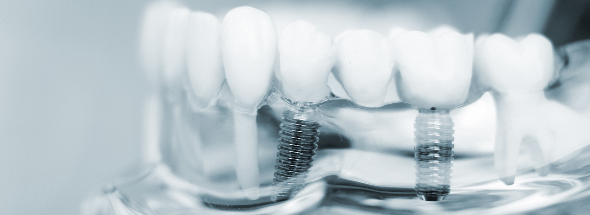 The image shows a close-up view of multiple toothbrushes with bristles, placed against a blurred background, possibly a laboratory setting.