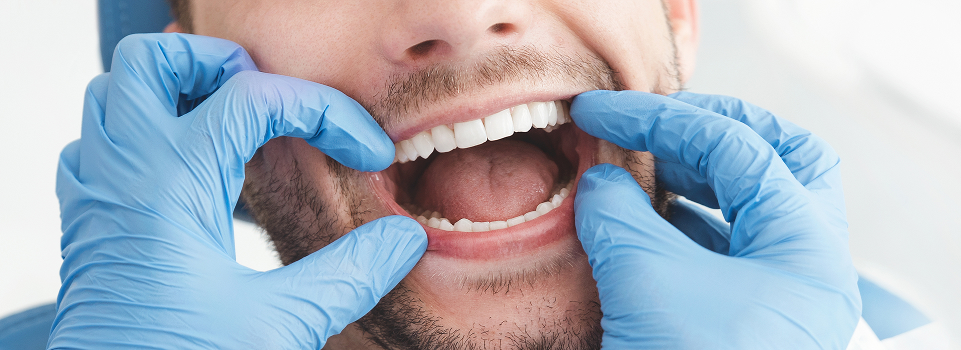 A man wearing blue gloves is holding his mouth open with both hands, displaying his teeth.