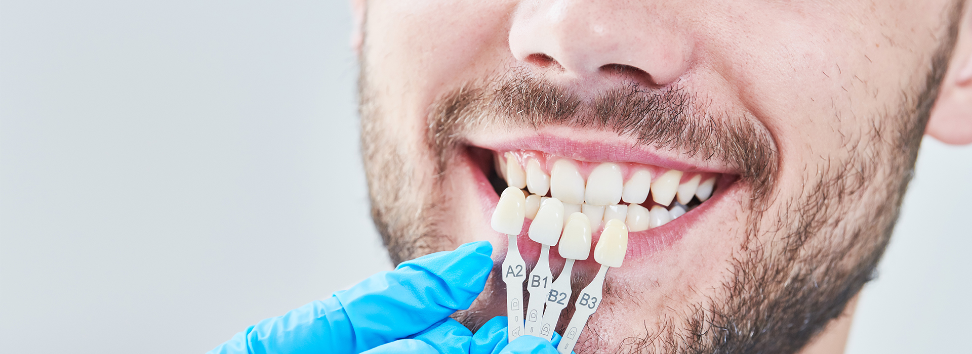 The image shows a man with a toothy grin undergoing dental treatment, with a dental implant fixture visible on his upper front teeth, wearing blue gloves and using a dental drill, set against a white background.